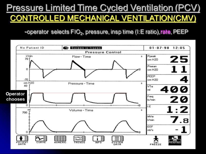 Pressure Limited Time Cycled Ventilation (PCV) CONTROLLED MECHANICAL VENTILATION(CMV)   -operator selects FIO2,